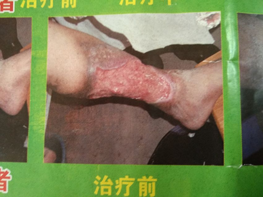 点击查看详细信息<br>标题：治疗前 阅读次数：676