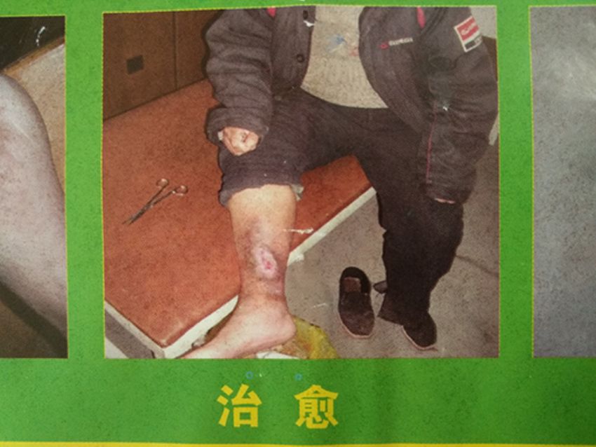 点击查看详细信息<br>标题：治愈 阅读次数：643