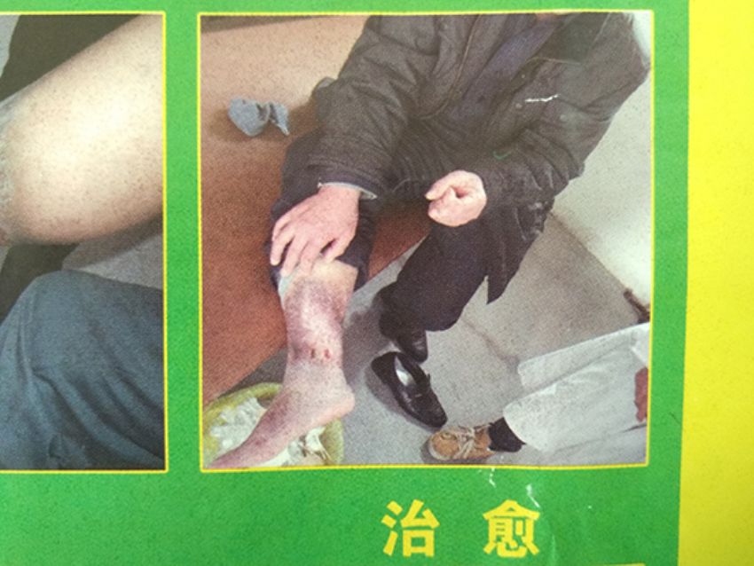 点击查看详细信息<br>标题：治愈 阅读次数：655