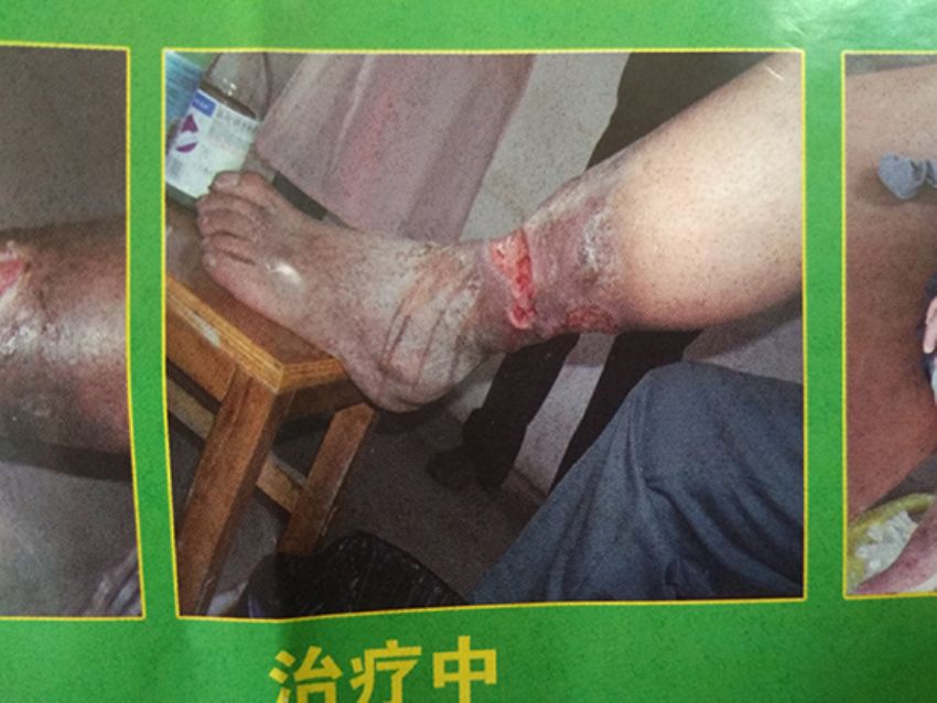 点击查看详细信息<br>标题：治疗中 阅读次数：704