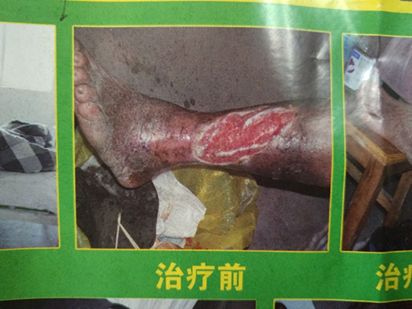 点击查看详细信息<br>标题：治疗前 阅读次数：647