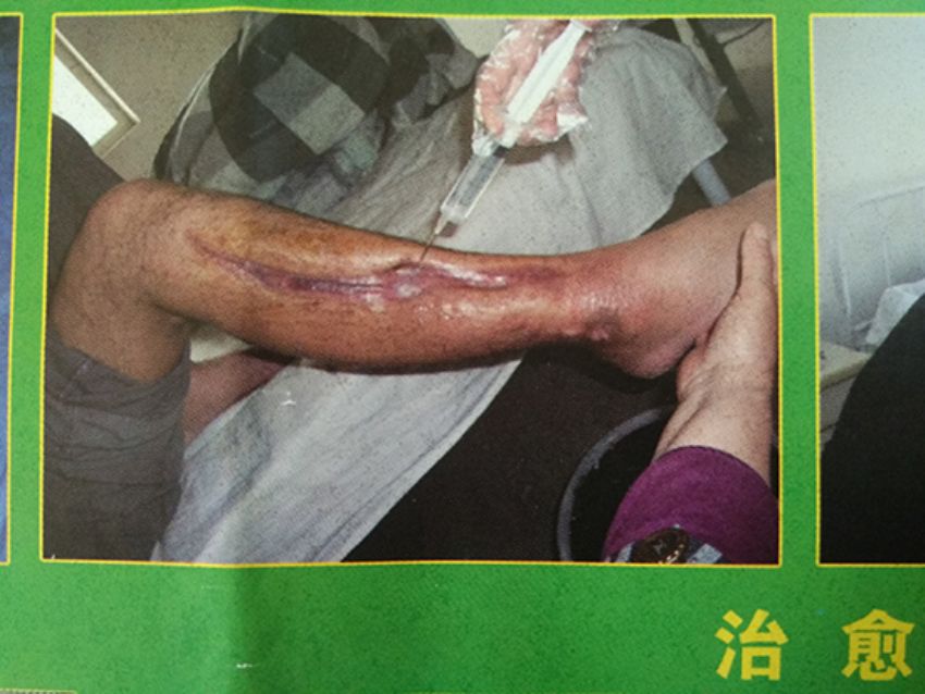 点击查看详细信息<br>标题：治愈 阅读次数：693