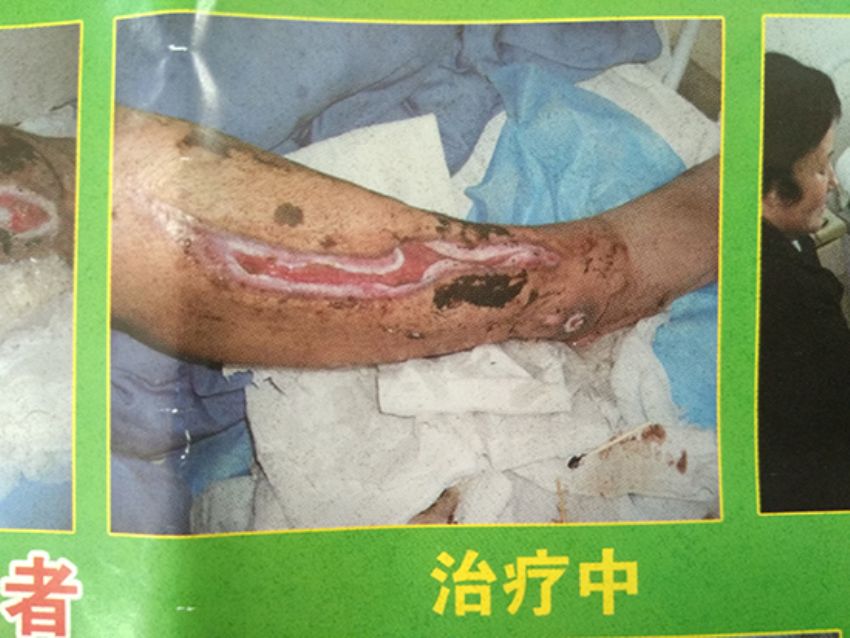 点击查看详细信息<br>标题：治疗中 阅读次数：661
