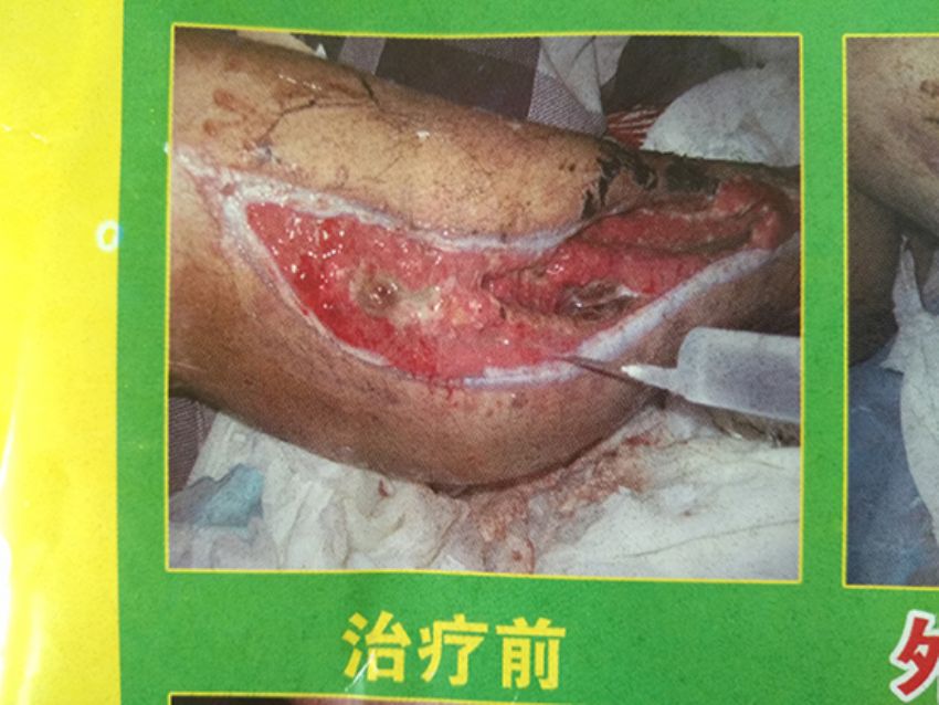 点击查看详细信息<br>标题：治疗前 阅读次数：718